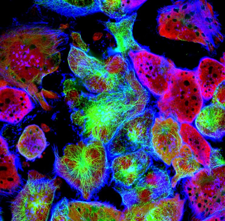 New Projeimmunofluorescence_in_tumor_cellsct